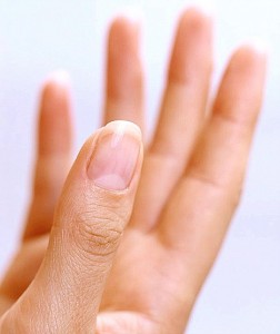 существует множество болезней ногтей на руках