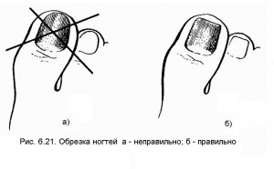 Схема правильного обрезания ногтей